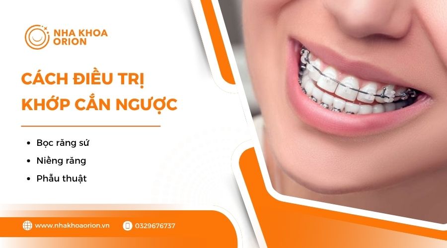 Cách điều trị khớp cắn ngược
