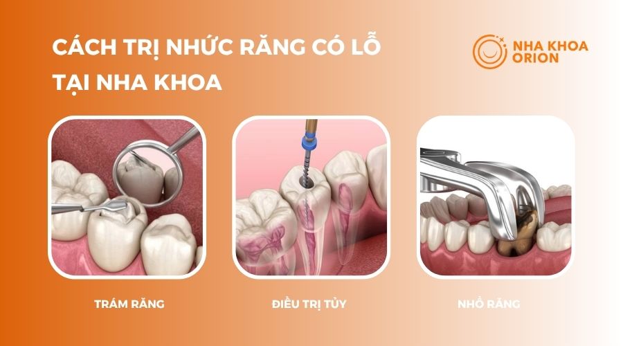 Cách trị nhức răng có lỗ tại nha khoa