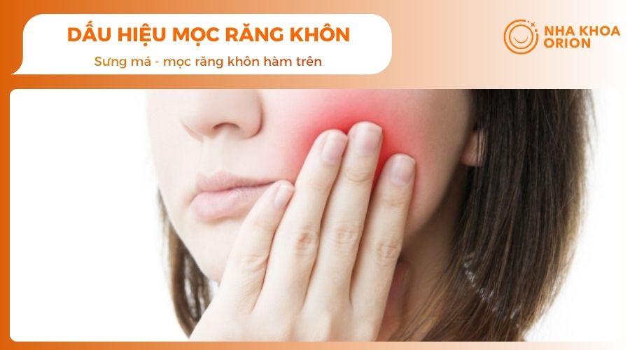 Mọc răng khôn bị sưng má