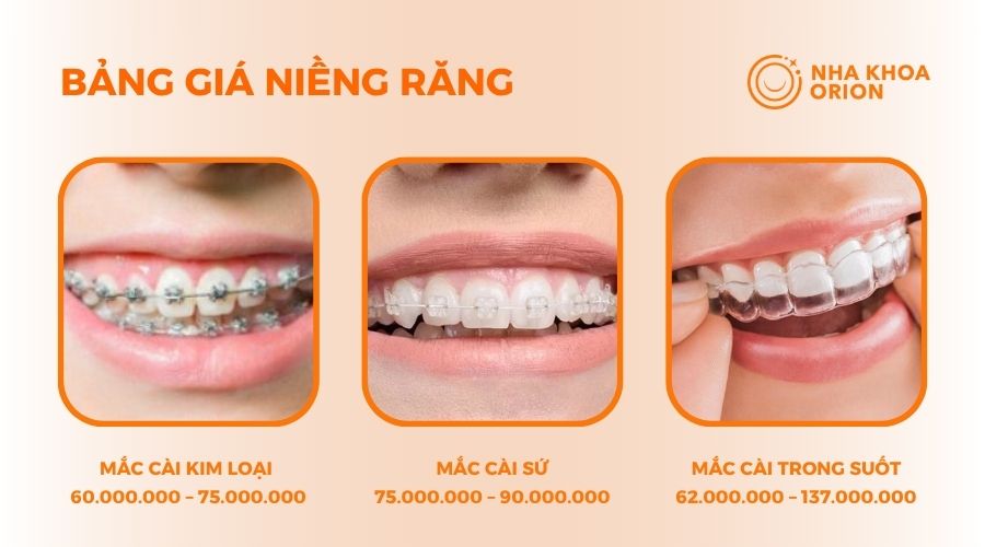 Chi phí niềng răng tại Nha Khoa Orion quận 9