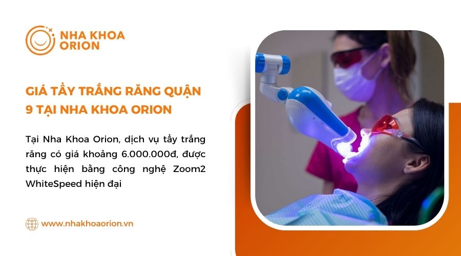 Giá tẩy trắng răng quận 9 tại Nha Khoa Orion