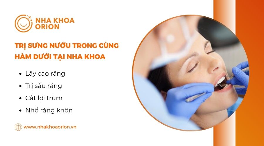 Cách trị sưng nướu răng trong cùng hàm dưới tại nha khoa
