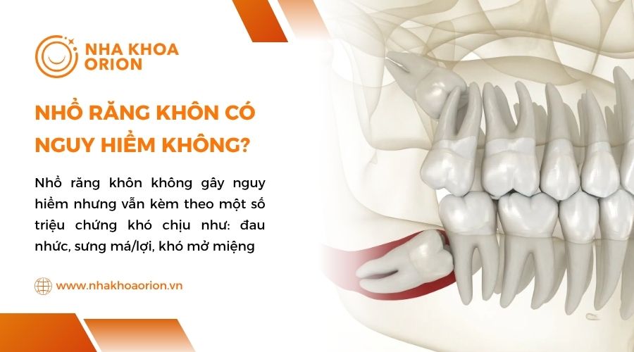 Nhổ răng kh&ocirc;n c&oacute; nguy hiểm kh&ocirc;ng?