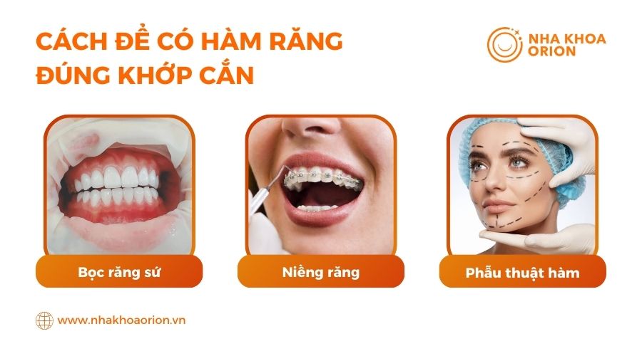 Cách để có hàm răng đúng khớp cắn