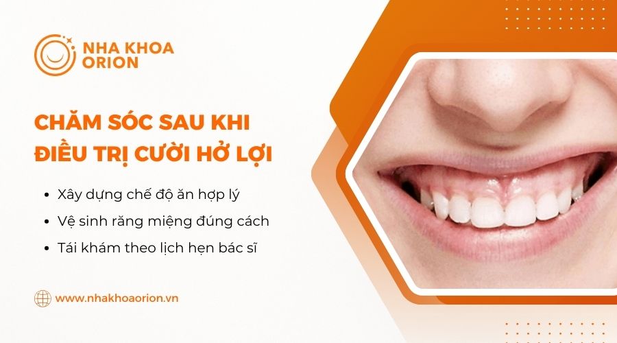 C&aacute;ch chăm s&oacute;c sau khi điều trị cười hở lợi