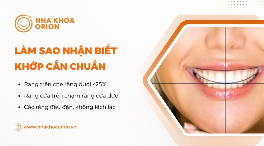 Làm sao để nhận biết khớp cắn chuẩn