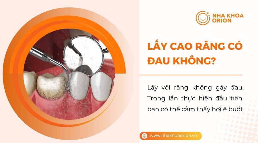 Lấy cao răng có đau không?