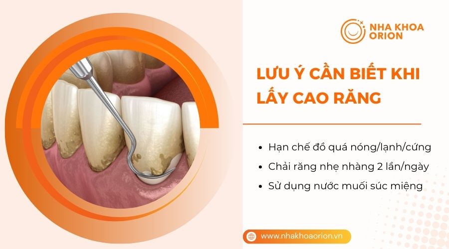 Một số lưu ý sau khi lấy cao răng để giảm đau