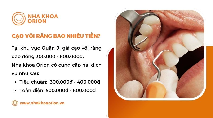 Giá cạo vôi răng tại Nha khoa Orion Quận 9