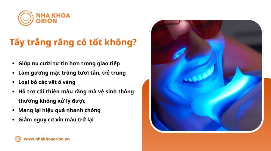 Tẩy trắng răng có tốt không?
