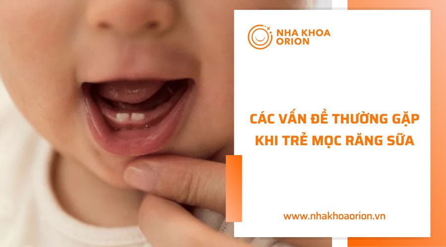 Các vấn đề thường gặp khi trẻ mọc răng sữa