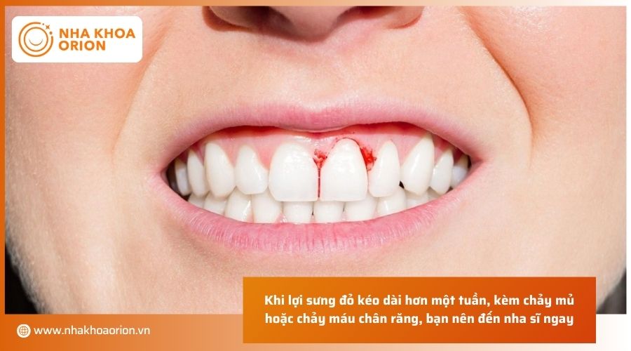 Khi nào cần thăm khám bác sĩ?