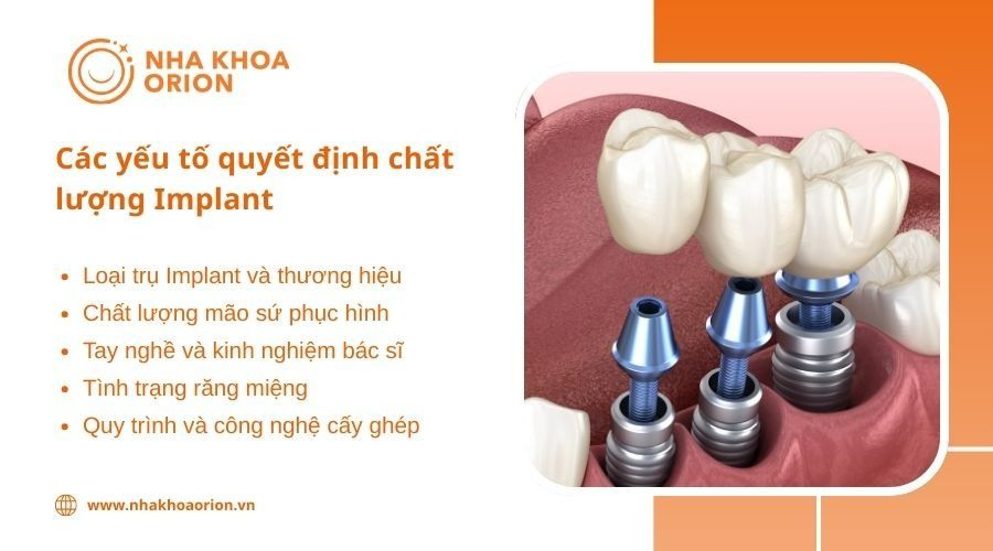 Những tiêu chí cần biết khi trồng răng Implant