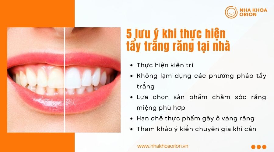 lưu &yacute; khi thực hi&ecirc;̣n t&acirc;̉y trắng răng tại nh&agrave;