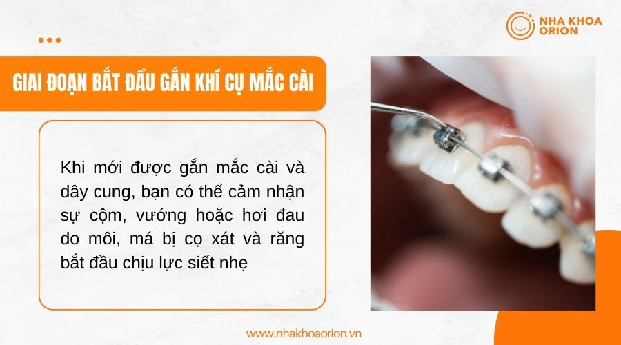 Giai đoạn bắt đầu gắn kh&iacute; cụ mắc c&agrave;i