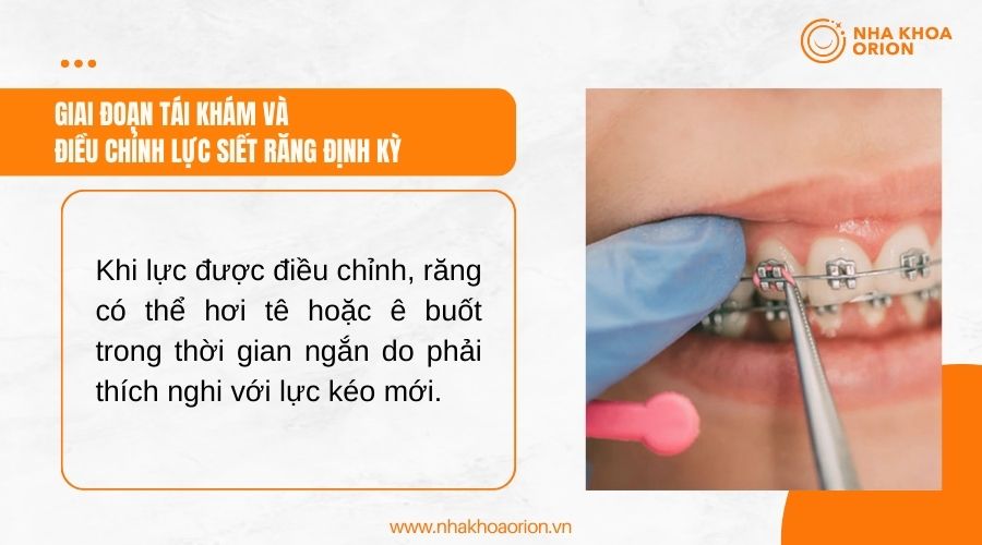 Giai đoạn t&aacute;i kh&aacute;m v&agrave; điều chỉnh lực siết răng định kỳ