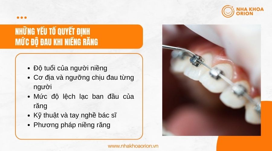 Những yếu tố quyết định mức độ đau khi niềng răng