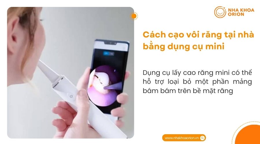 C&aacute;ch cạo v&ocirc;i răng tại nh&agrave; bằng dụng cụ mini