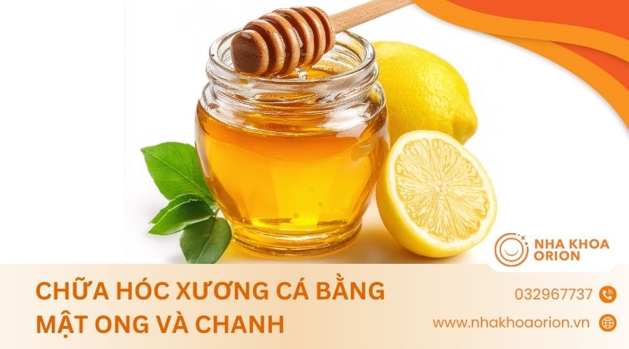C&aacute;ch chữa h&oacute;c xương c&aacute; bằng mật ong v&agrave; chanh