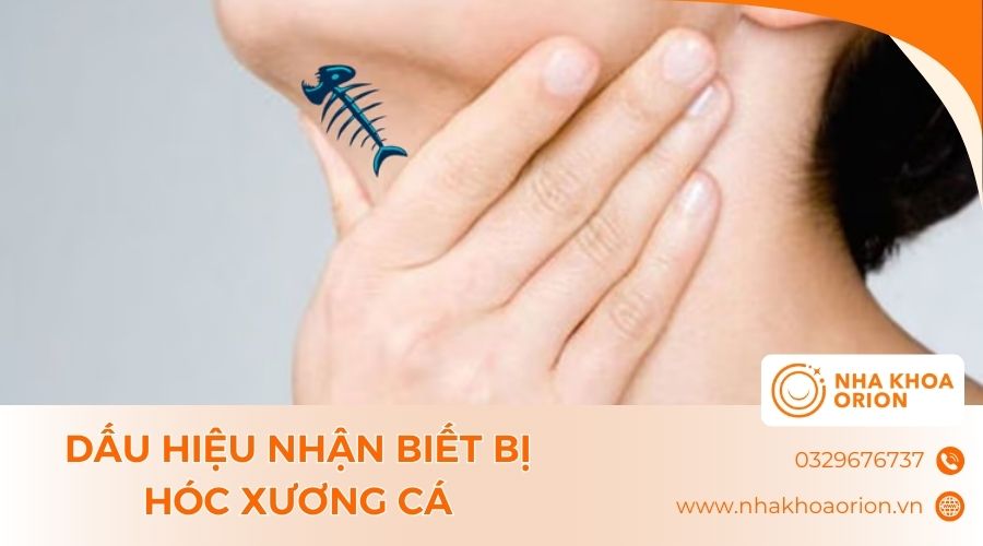 Dấu hiệu phổ biến khi bị h&oacute;c xương c&aacute;