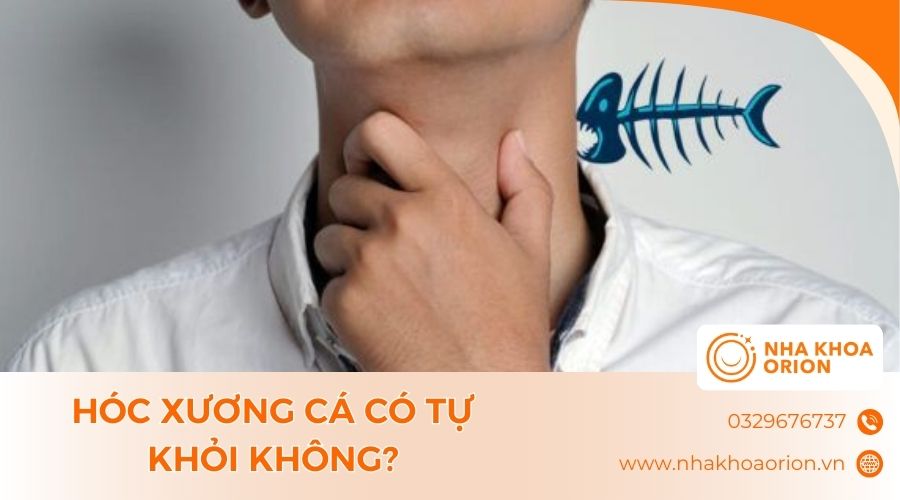 H&oacute;c xương c&aacute; c&oacute; thể tự khỏi t&ugrave;y v&agrave;o k&iacute;ch thước xương