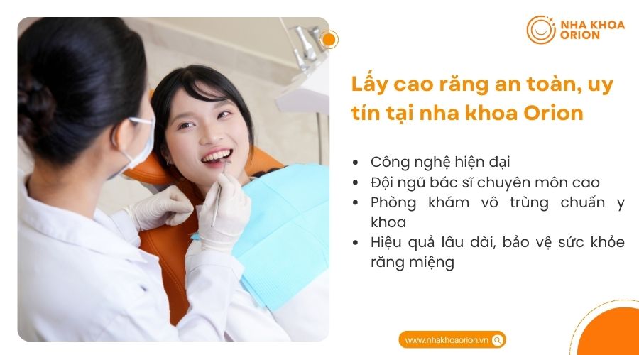 Lấy cao răng an to&agrave;n, uy tín tại nha khoa Orion