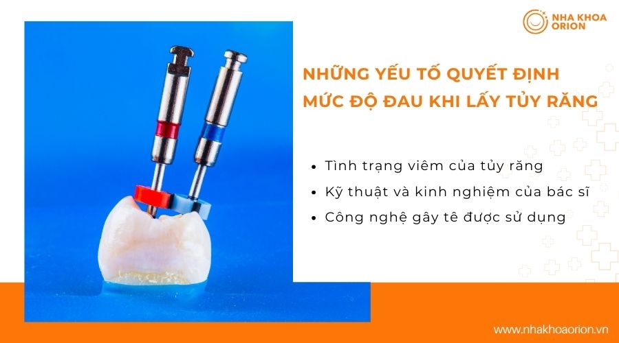 Những yếu tố quyết định mức độ đau khi lấy tủy răng