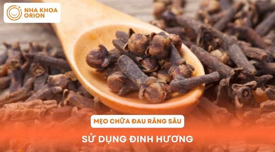 Mẹo chữa đau răng s&acirc;u bằng đinh hương