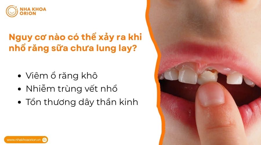 Nhổ răng sữa chưa lung lay c&oacute; nguy hiểm kh&ocirc;ng?