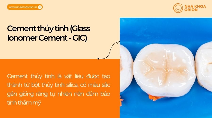 Cement thủy tinh (Glass Ionomer Cement - GIC)