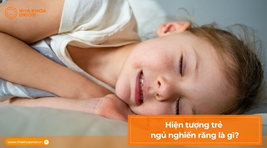 Hi&ecirc;̣n tượng trẻ ngủ nghiến răng là gì?