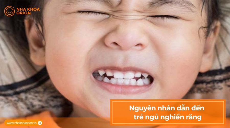Nguy&ecirc;n nh&acirc;n g&acirc;y nghiến răng khi ngủ​