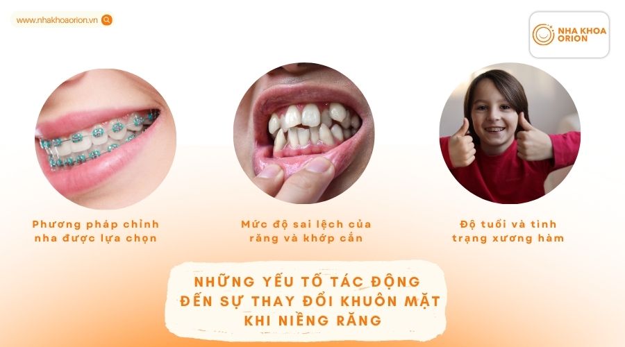 Những yếu tố t&aacute;c động đến sự thay đổi khu&ocirc;n mặt khi niềng răng
