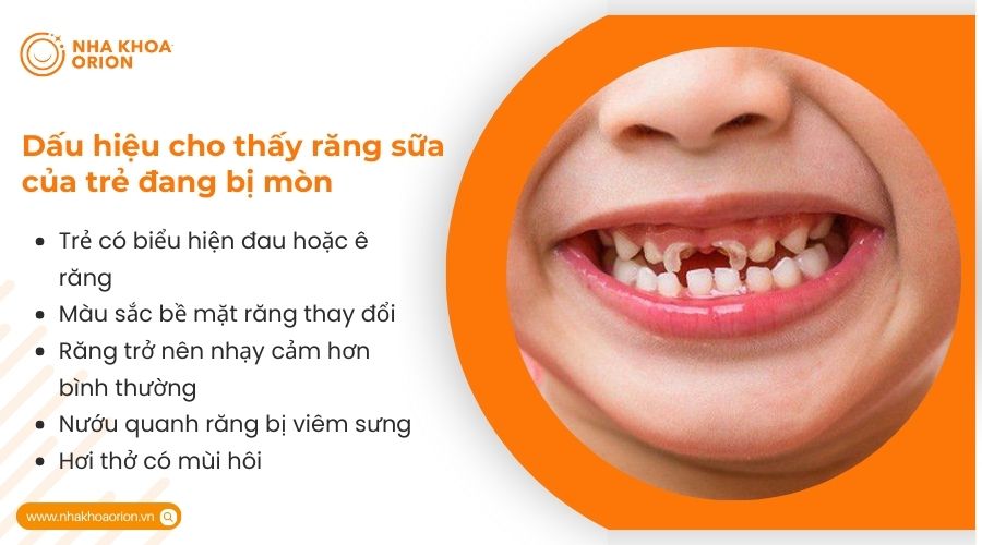 Dấu hiệu cho thấy răng sữa của trẻ đang bị m&ograve;n