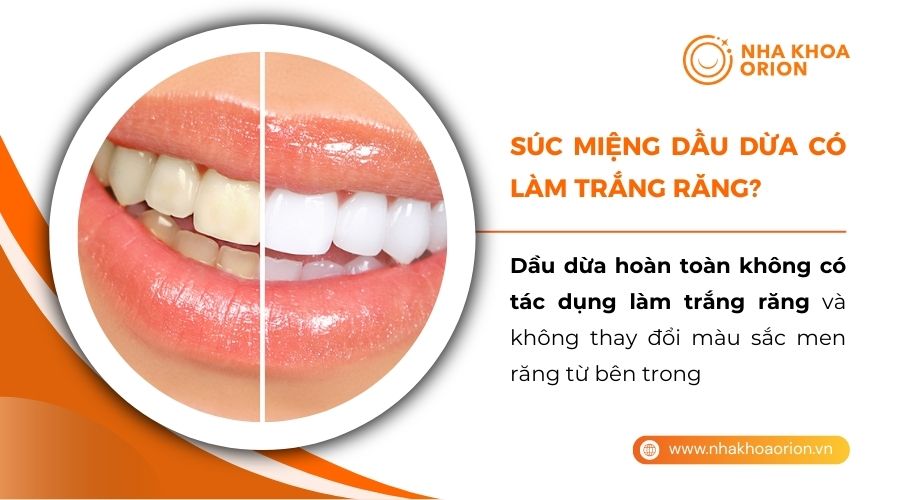 S&uacute;c miệng bằng dầu dừa chỉ hỗ trợ đ&aacute;nh bay mảng b&aacute;m tr&ecirc;n răng