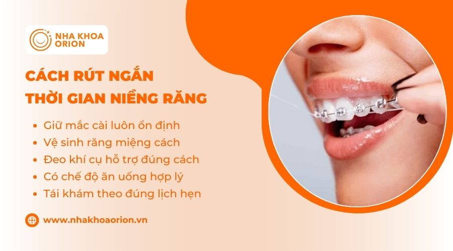 C&aacute;ch r&uacute;t ngắn thời gian niềng răng nhanh ch&oacute;ng