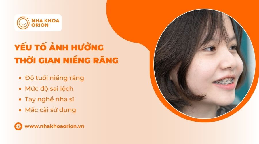 Độ tuổi l&agrave; một trong những yếu tố chủ chốt quyết định thời gian niềng răng