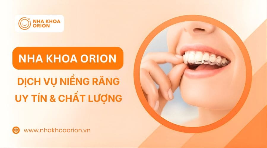 Nha khoa Orion chuy&ecirc;n niềng răng mắc c&agrave;i, niềng răng Invisalign
