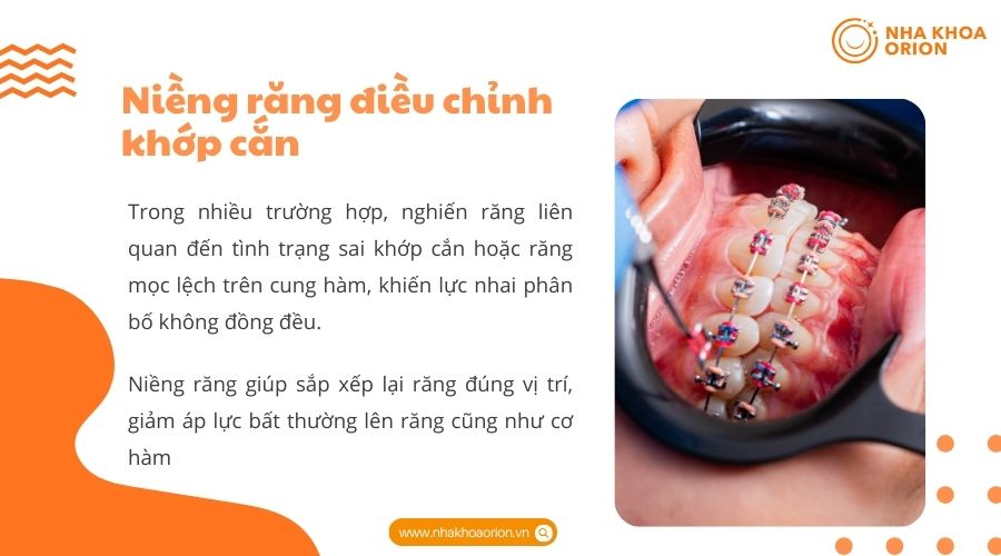 Niềng răng điều chỉnh khớp cắn