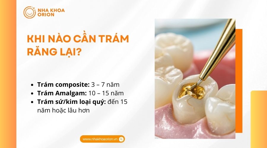 Khi nào cần trám răng lại?