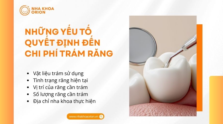 Những yếu tố quyết định đến chi phí trám răng