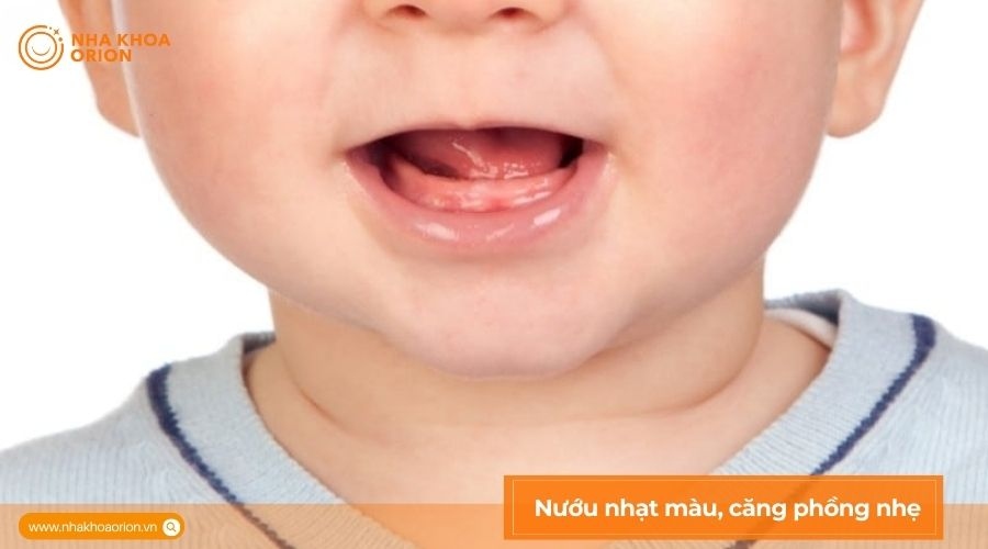 H&igrave;nh ảnh lợi trẻ sắp mọc răng