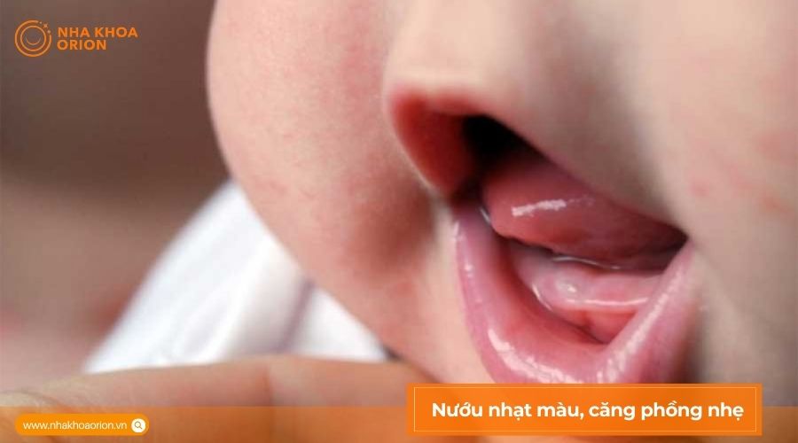 H&igrave;nh ảnh lợi trẻ sắp mọc răng