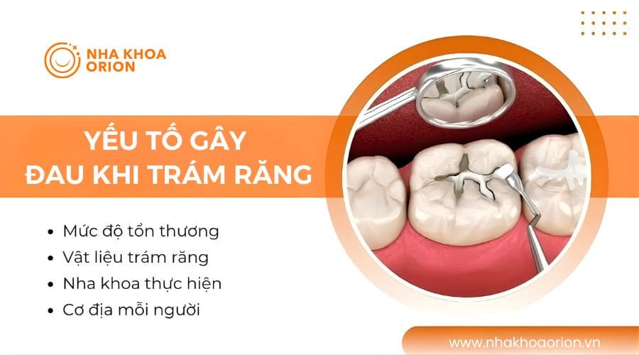 Những yếu tố ảnh hưởng đến mức độ đau khi trám răng