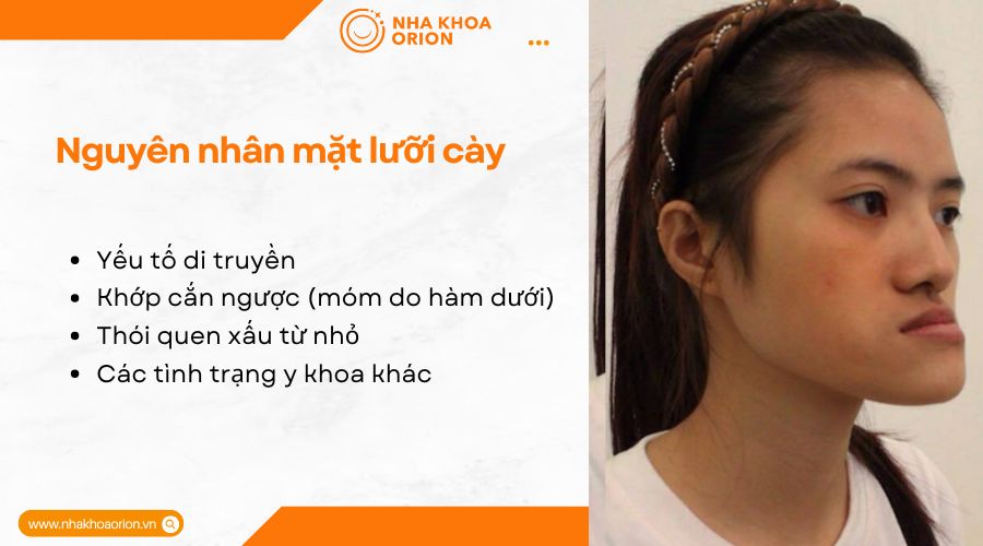 Nguy&ecirc;n nh&acirc;n dẫn đến mặt lưỡi c&agrave;y
