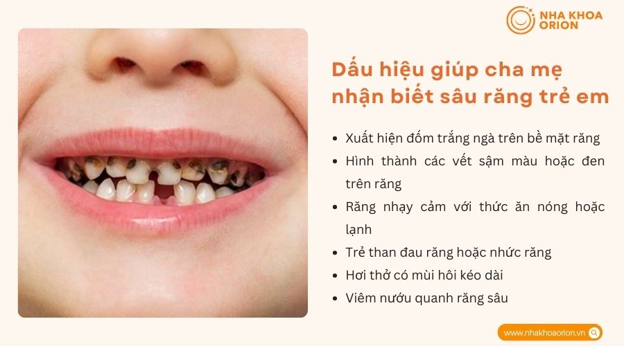 Dấu hiệu giúp cha mẹ nhận biết sâu răng trẻ em