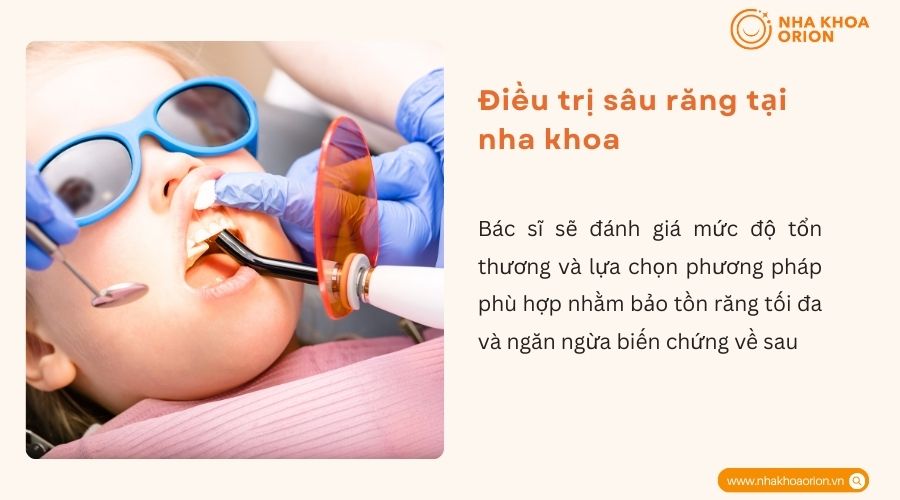 Điều trị sâu răng tại nha khoa