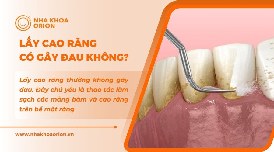 Giải đ&aacute;p cạo v&ocirc;i răng c&oacute; đau kh&ocirc;ng
