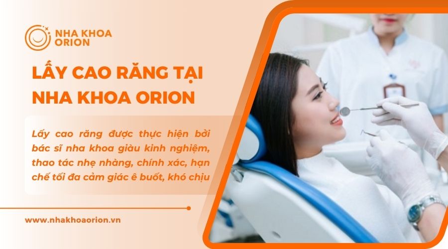 Dịch vụ lấy cao răng tại Nha khoa Orion