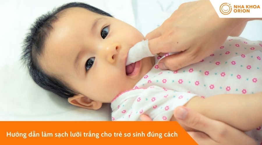 C&aacute;ch l&agrave;m sạch lưỡi bị trắng cho trẻ sơ sinh đ&uacute;ng c&aacute;ch
